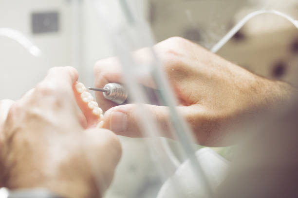 polishing dentures in dental laboratory - dentures imagens e fotografias de stock