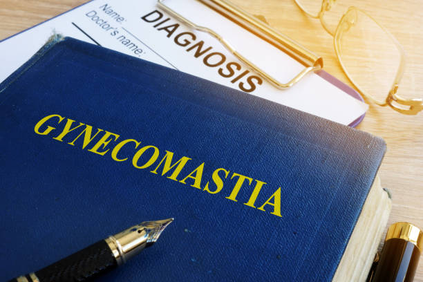 istock Book about Gynecomastia on a hospital table. 914081098