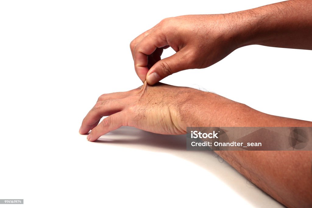 hand of adult asian man  pull the hand skin  on white background isolated Pinching Stock Photo