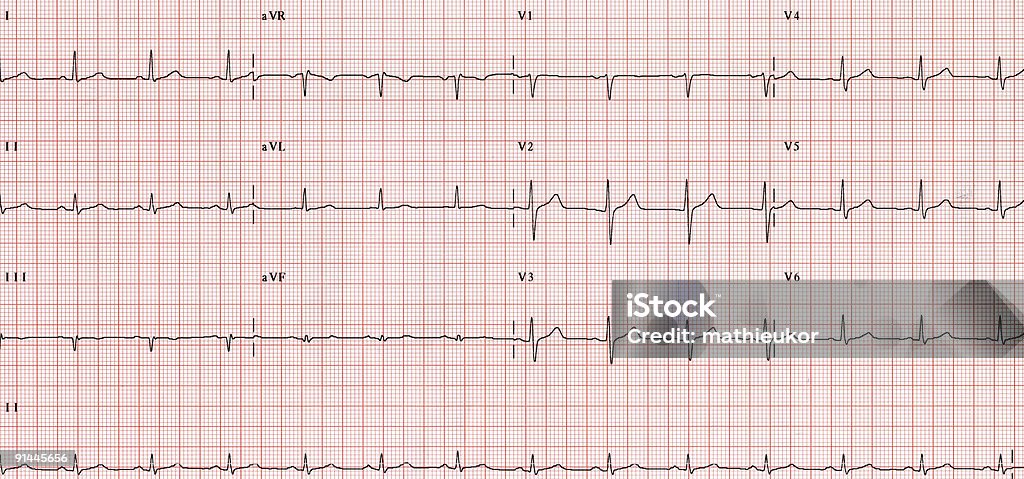 XXL-ECG- Diagramm - Lizenzfrei Pulslinie Stock-Foto