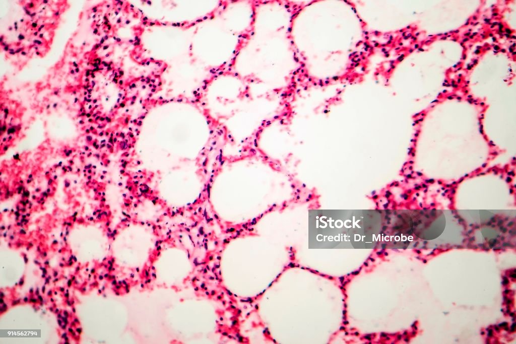 Tejido pulmonar de fotografía microscópica que muestra - Foto de stock de Anatomía libre de derechos