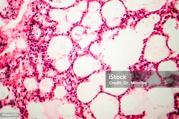 Tejido Pulmonar De Fotografía Microscópica Que Muestra Foto de stock y más banco de imágenes de Anatomía