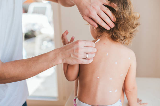 Стрептодермия у детей на ногах Foto-Leto.ru