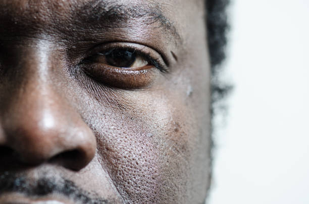 Close up on the left eye and nose of a black young adult man Close up on the left eye and nose of a black young adult man bruise photos stock pictures, royalty-free photos & images