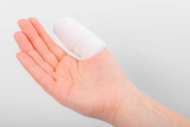 istock Injured finger with bandage 914775778