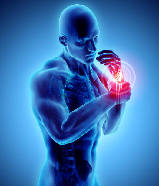 istock Wrist painful - skeleton x-ray. 914924806
