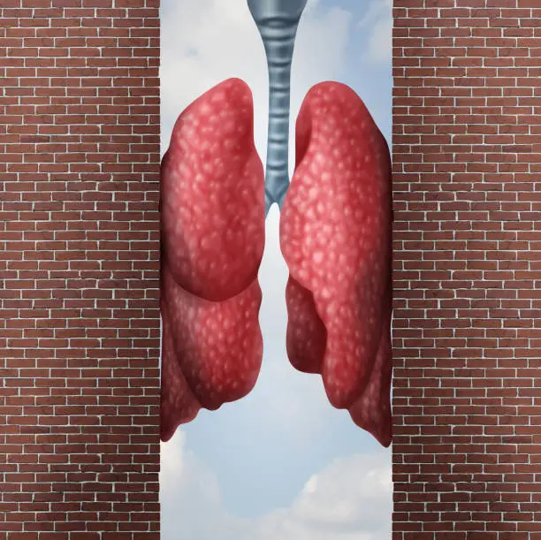 Asthma health problem concept as difficulty in breathing caused by respiratory distress with the tightening of air passage as lungs constricted with 3D illustration elements.