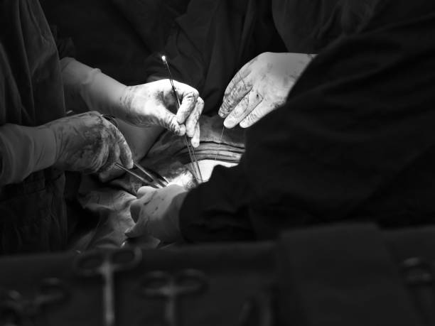 black and white color tone of surgeon and assistant team while doing operation in operating room at hospital - nurse hygiene emotional stress surgeon imagens e fotografias de stock