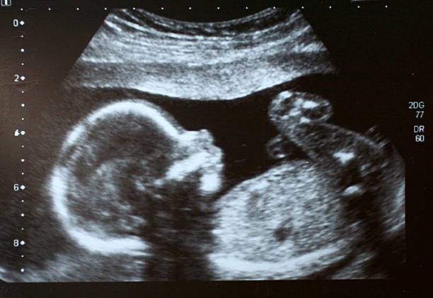 ecografía del feto - abdomen fotos fotografías e imágenes de stock