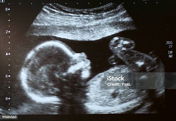 Foetus Ultrasound Stock Photo - Download Image Now - Ultrasound, Baby - Human Age, Fetus