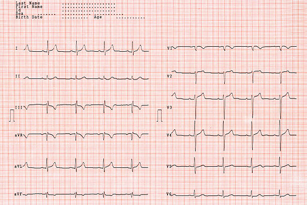 istock ecg taken in an emergency room XL 91615576