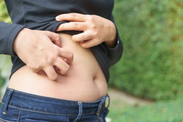 Chubby woman hand scratching her own belly fat. stock photo