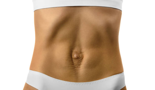 diastase. divergence de ventre de la femme des muscles de l’abdomen après la grossesse et l’accouchement. - belly button photos et images de collection