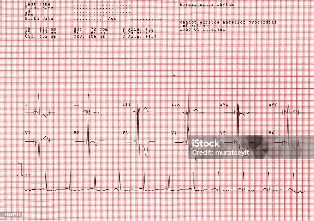 ecg Seriennummer XXL - Lizenzfrei Computerausdruck Stock-Foto