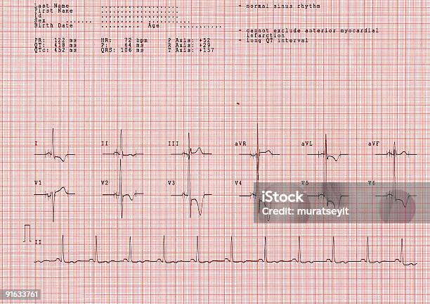 Ecg Seriennummer Xxl Stockfoto und mehr Bilder von Computerausdruck - Computerausdruck, Farbbild, Fotografie