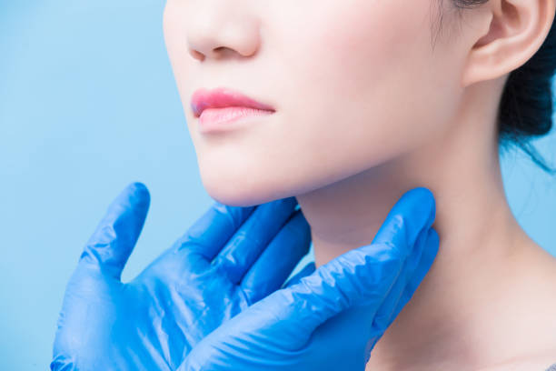 women with thyroid gland problem women with thyroid gland problem on the blue background lymphoma photos stock pictures, royalty-free photos & images