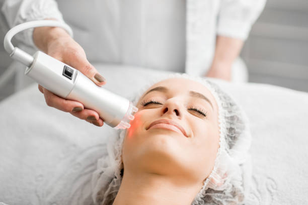 femme au cours d’un massage du visage - laser photos et images de collection