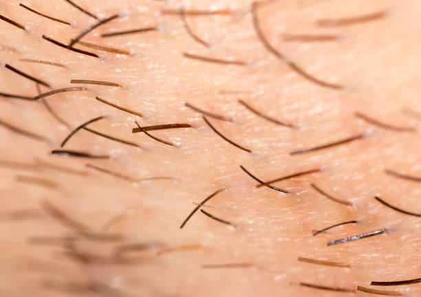 istock Bristles on the beard of a man 916790252