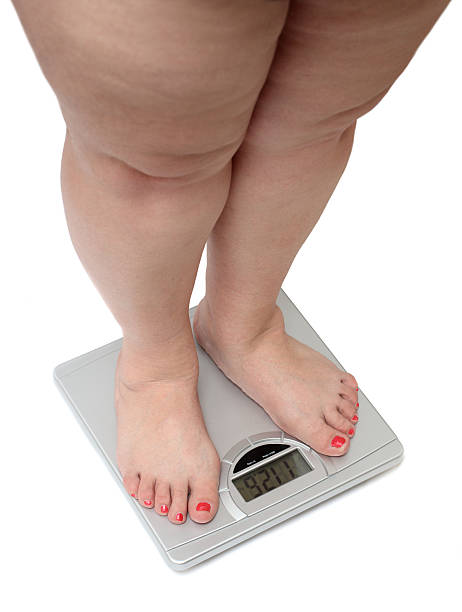 istock women legs with overweight 91685263