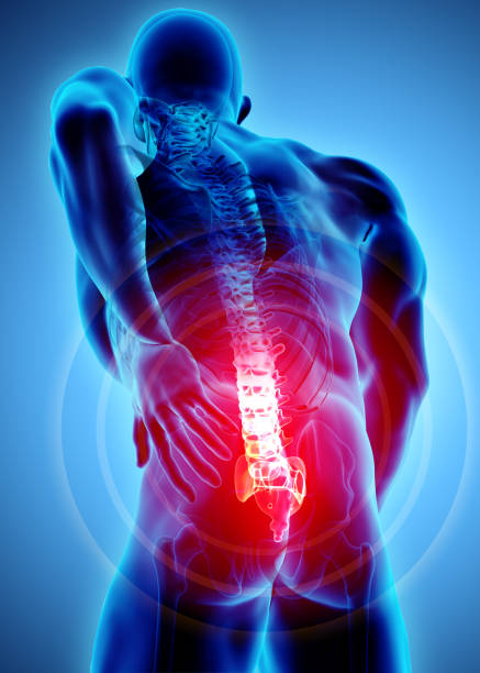 istock 3D Illustration of sacral spine painful. 916995346