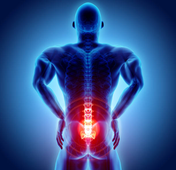 istock 3D Illustration of sacral spine painful. 916995348