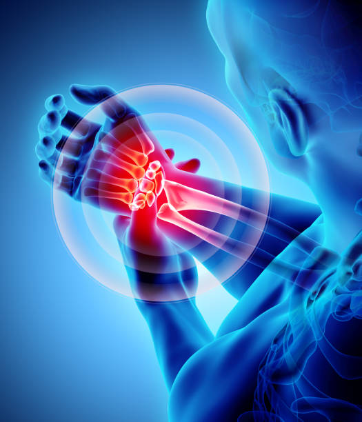 istock Wrist painful - skeleton x-ray. 916995356