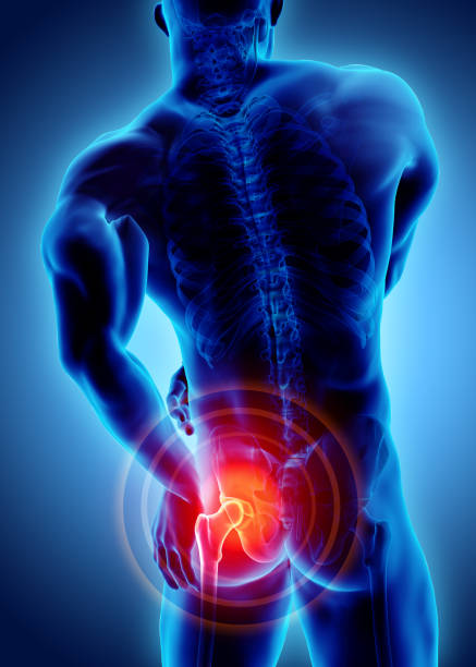 istock Hip painful skeleton x-ray, 3D illustration. 916995372