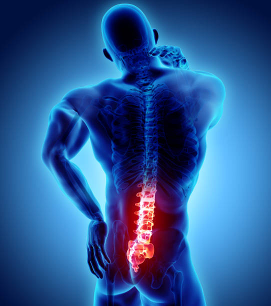 istock 3D Illustration of sacral spine painful. 916995376