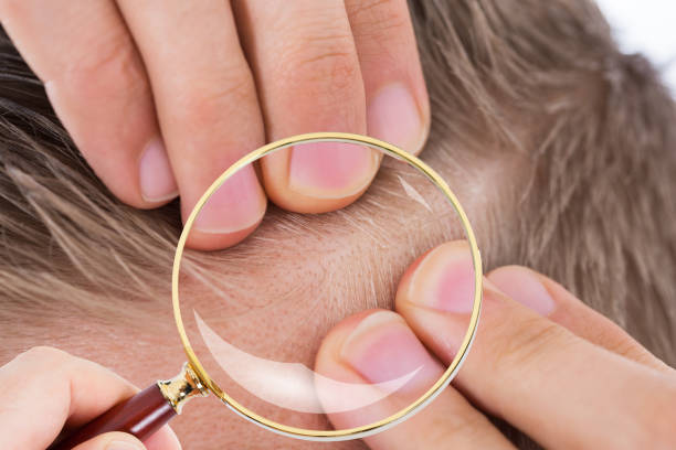 istock Dermatologist Checking Patient's Hair 917037274