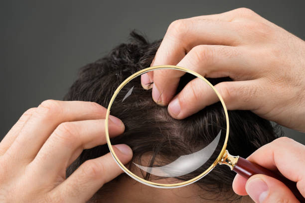 患者の髪をチェックする皮膚科医 - human scalp ストックフォトと画像