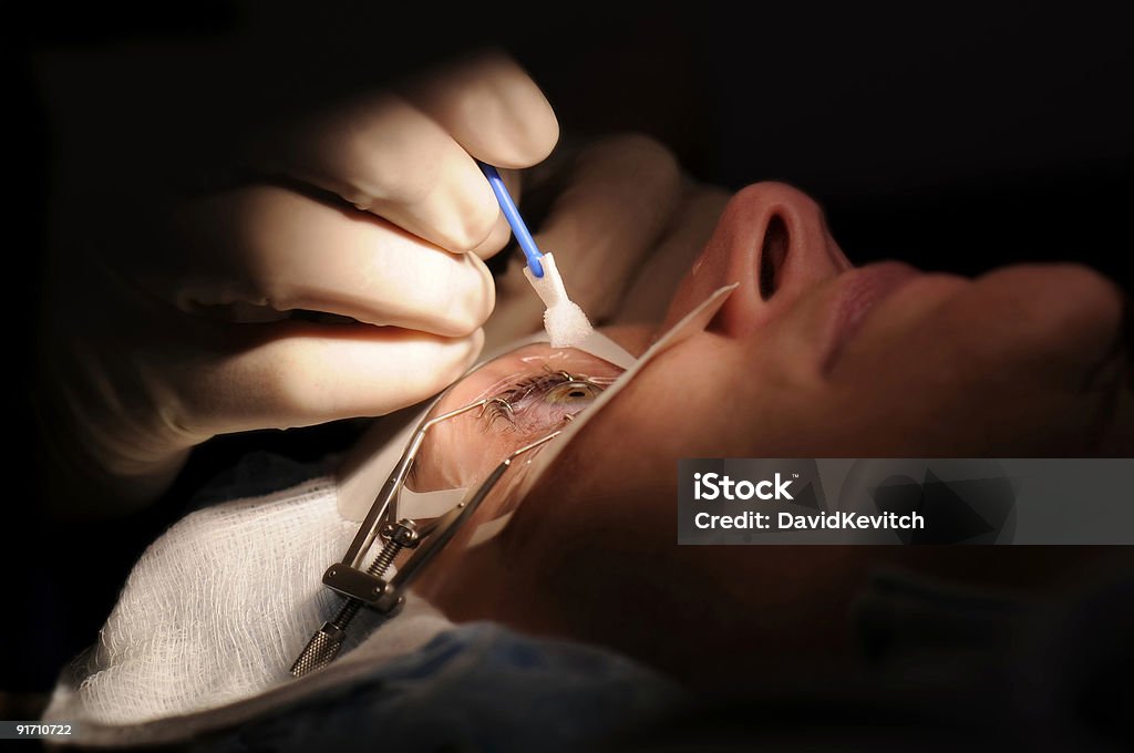 Lasik Intervento di chirurgia oftalmica - Foto stock royalty-free di Intervento di chirurgia oftalmica