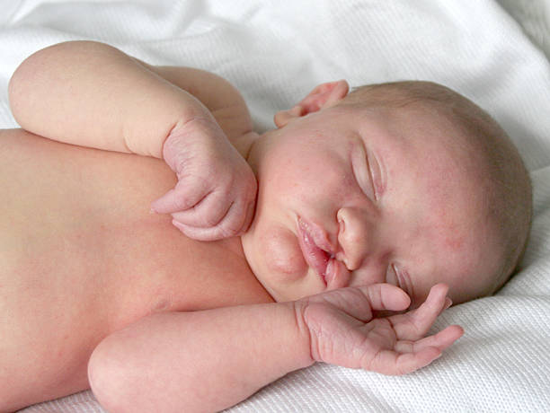Newborn Baby with Cleft Lip  cleft lip stock pictures, royalty-free photos & images