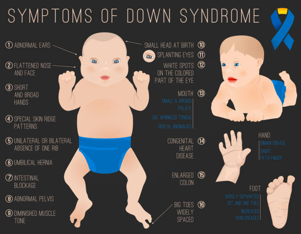 down syndrom symptome - down syndrome stock-grafiken, -clipart, -cartoons und -symbole