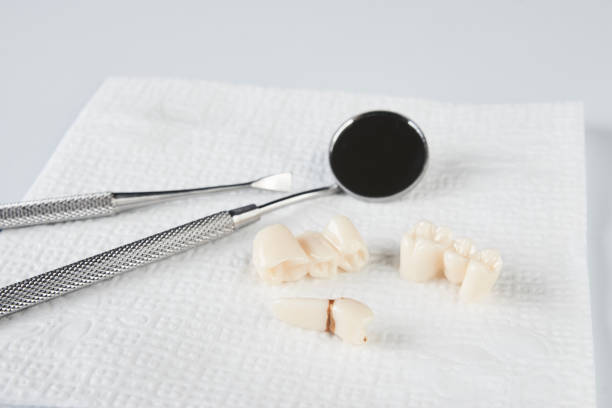 istock Removed wisdom tooth on white napkin and dental equipment 917436718