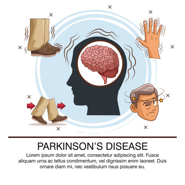 illustrazioni stock, clip art, cartoni animati e icone di tendenza di infografica sul morbo di parkinson - nerve cell healthcare and medicine research human hand