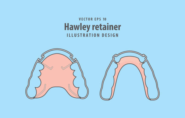 Hawley retainer illustration vector on blue background. Dental concept. Hawley retainer illustration vector on blue background. Dental concept. orthodontist stock illustrations