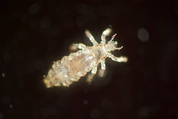 Macro Shot of live head lice