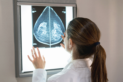 Unrecognizable female gynocologist looking at a mammogram at the hospital