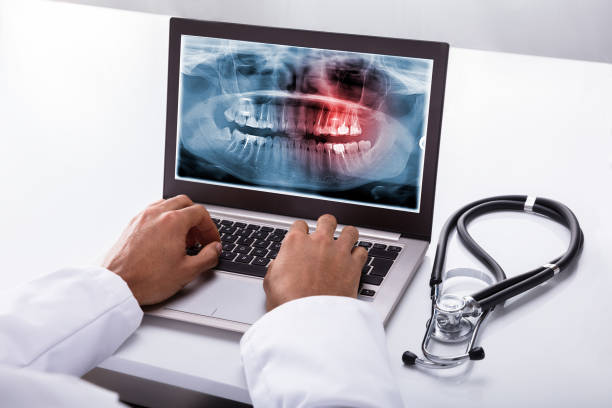 istock Dentist Typing On Laptop With Dental X-ray On Screen 917885424