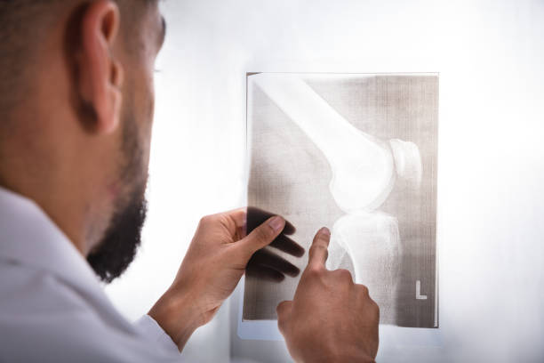 istock Doctor Examining Knee X-ray 917885460