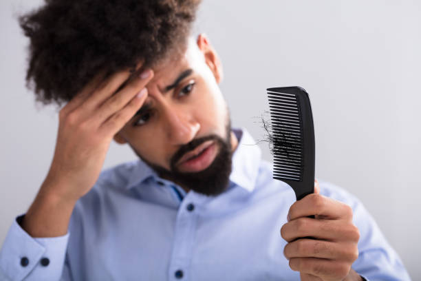 istock Man Looking At Hair Loss 917885488