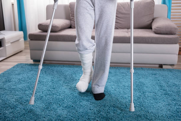 istock Low Section View Of A Man's Plastered Leg 917885522
