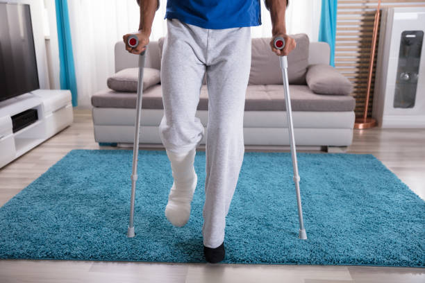 istock Low Section View Of A Man's Plastered Leg 917885528