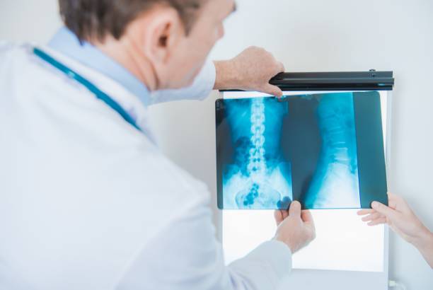 istock Xray Images Doctor Diagnosis 917994560