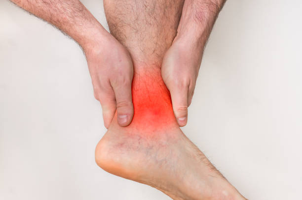 istock Man with ankle pain holding his aching leg 918006664