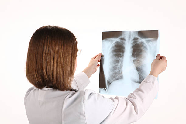 istock Female Doctor looking at lungs X-Ray 91825428