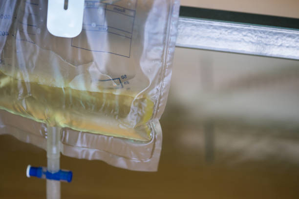 plastic urine collection bag hang under patient bed in hospital plastic urine collection bag hang under patient bed in hospital catheter photos stock pictures, royalty-free photos & images