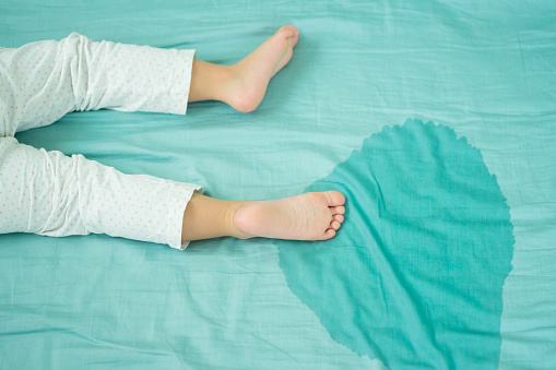 Kid's feet and pee in a mattress.Little girl feet and pee in bed sheet on the morning.Child development concept.