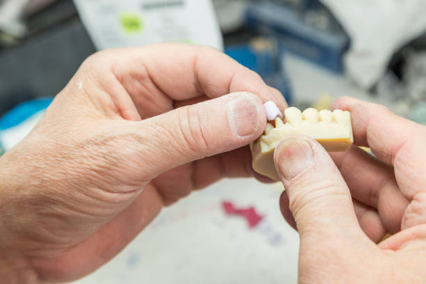 Dental Technician Working On 3D Printed Mold For Tooth Implants Male Dental Technician Working On A 3D Printed Mold For Tooth Implants In The Lab. 3d printing hand stock pictures, royalty-free photos & images