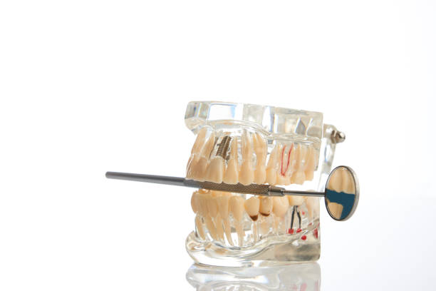 istock Dental jaw model with dental mirror 918673858